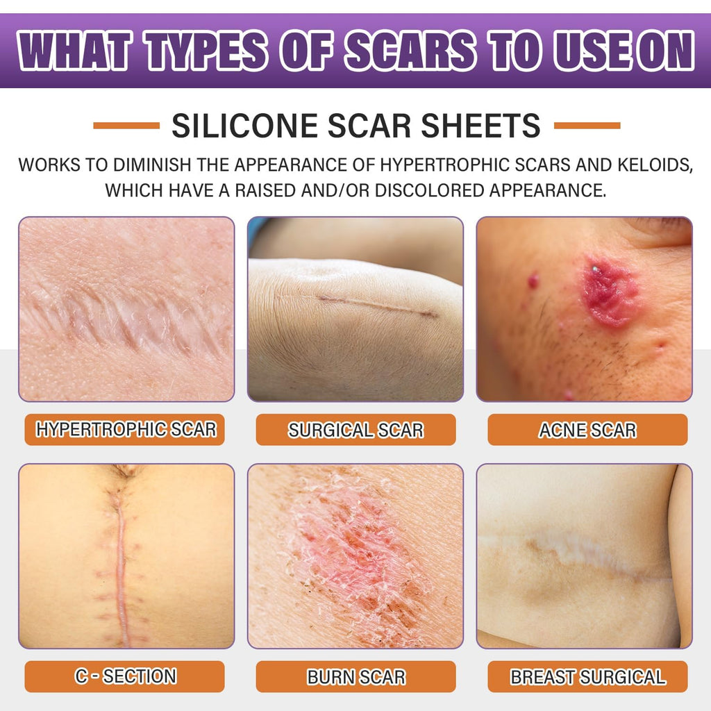 Silicone Scar Sheets Roll – Flexible Silicone Scar Tape for Skin Care