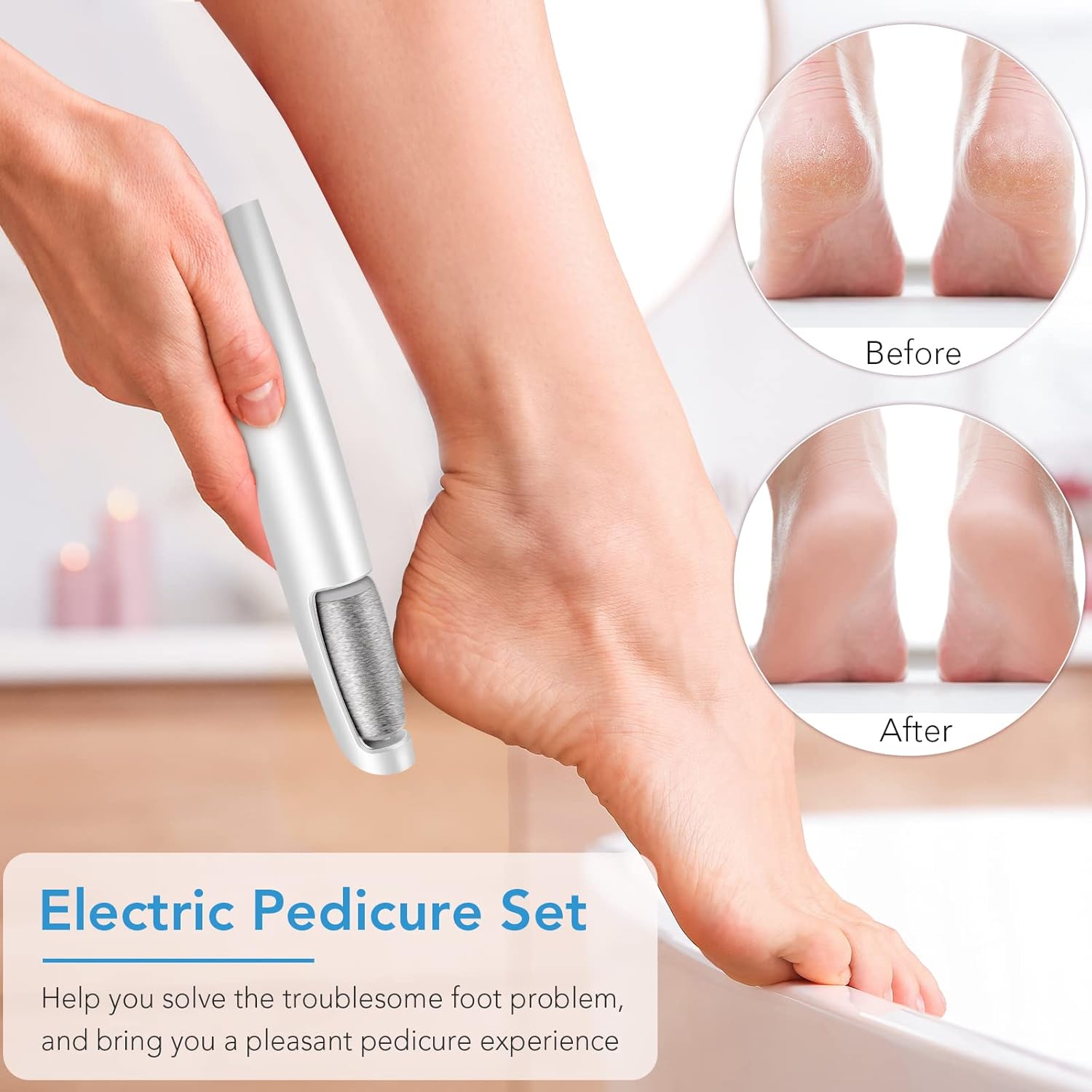 Electric Callus Remover for Feet – Professional Pedicure Foot Scrubber for Smooth Heels