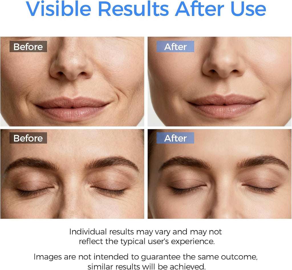 Skin Scrubber Face Spatula – Deep Cleansing Blackhead & Whitehead Remover