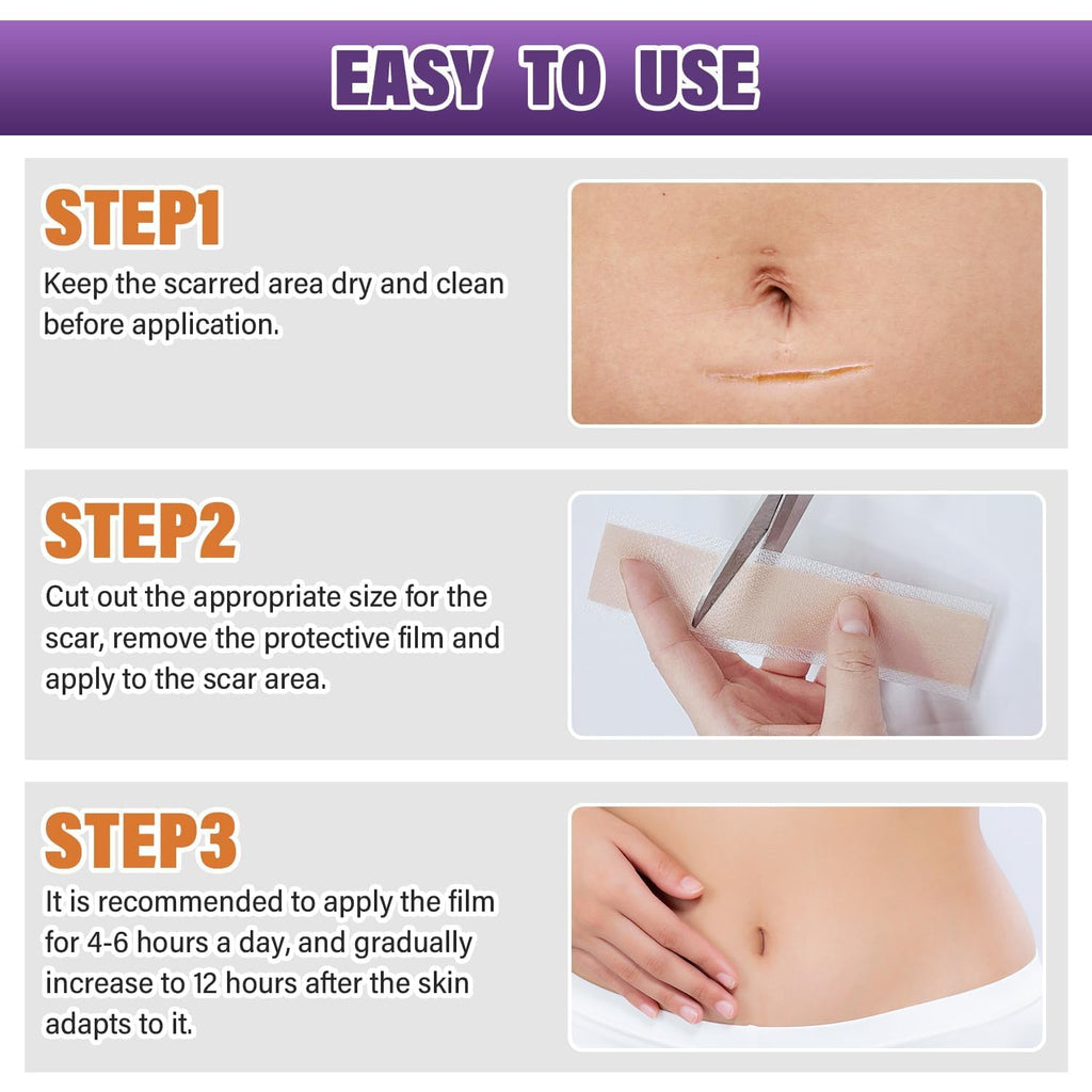 Silicone Scar Sheets Roll – Flexible Silicone Scar Tape for Skin Care